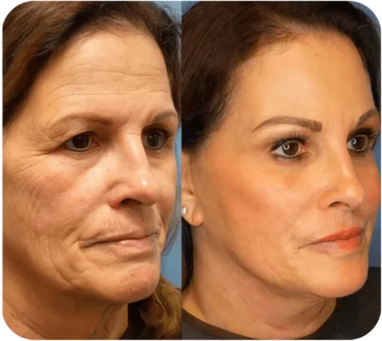 🔥【Replace new packing】Instant Face Tightener No-Filter Primer✨